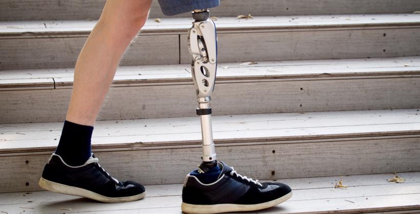 This image shows a man walking on steps after losing a leg in a catastrophic injury.