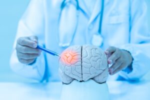Understanding Traumatic Brain Injury Claims in Georgia