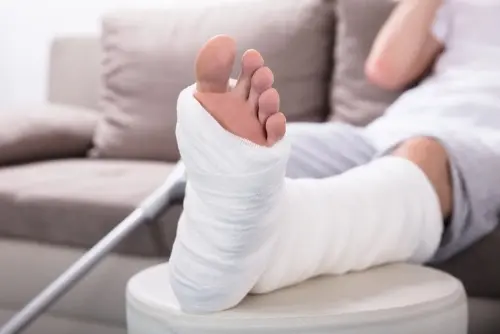 Injury Types broken bones is another common injury types from auto accidents